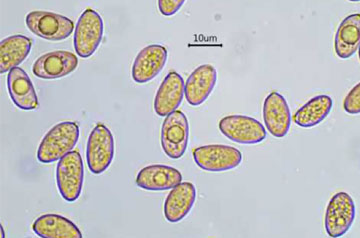 spore al microscopio